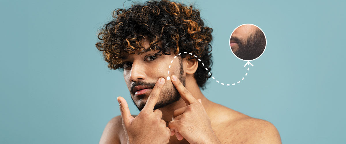 How to Grow Dense Beard on Cheeks