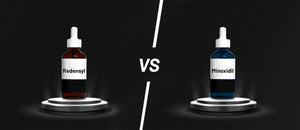 Redensyl Vs Minoxidil: Which is Better for Hair Growth?