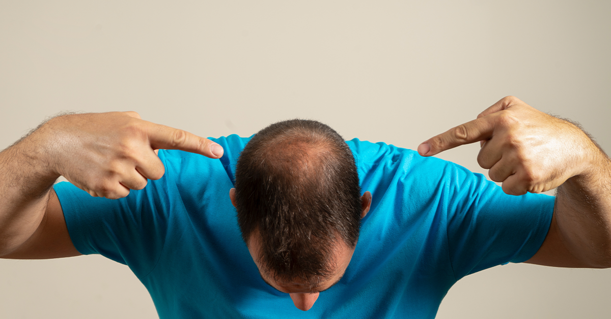How to Stop Hair Loss in Teenage Guys? | Hair Loss Causes and Prevention in Teenage Males