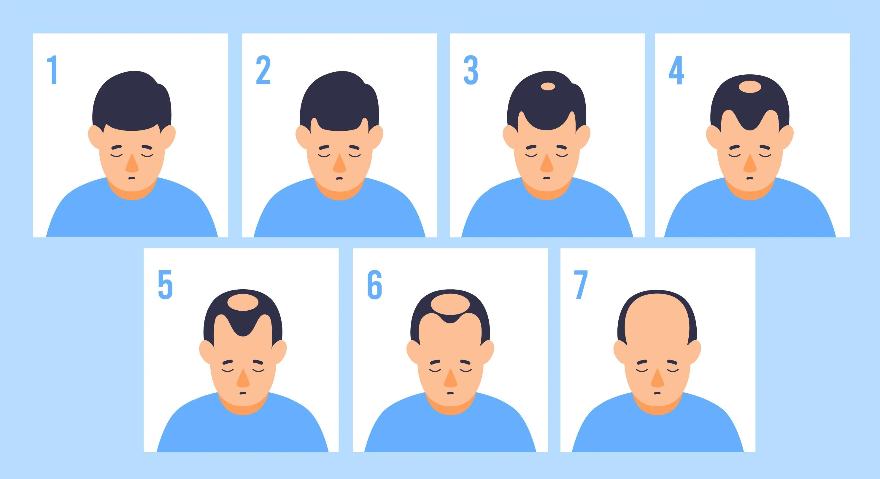 Male Pattern Baldness 7 Different Stages Of Hair Loss In Men Formen male-pattern-baldness-7-different-stages-of-hair-loss-in-men-formen