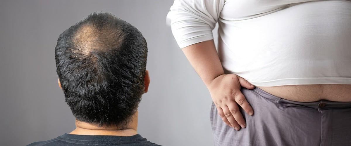 क्या कम टेस्टोस्टेरोन के कारण बाल झड़ते हैं?