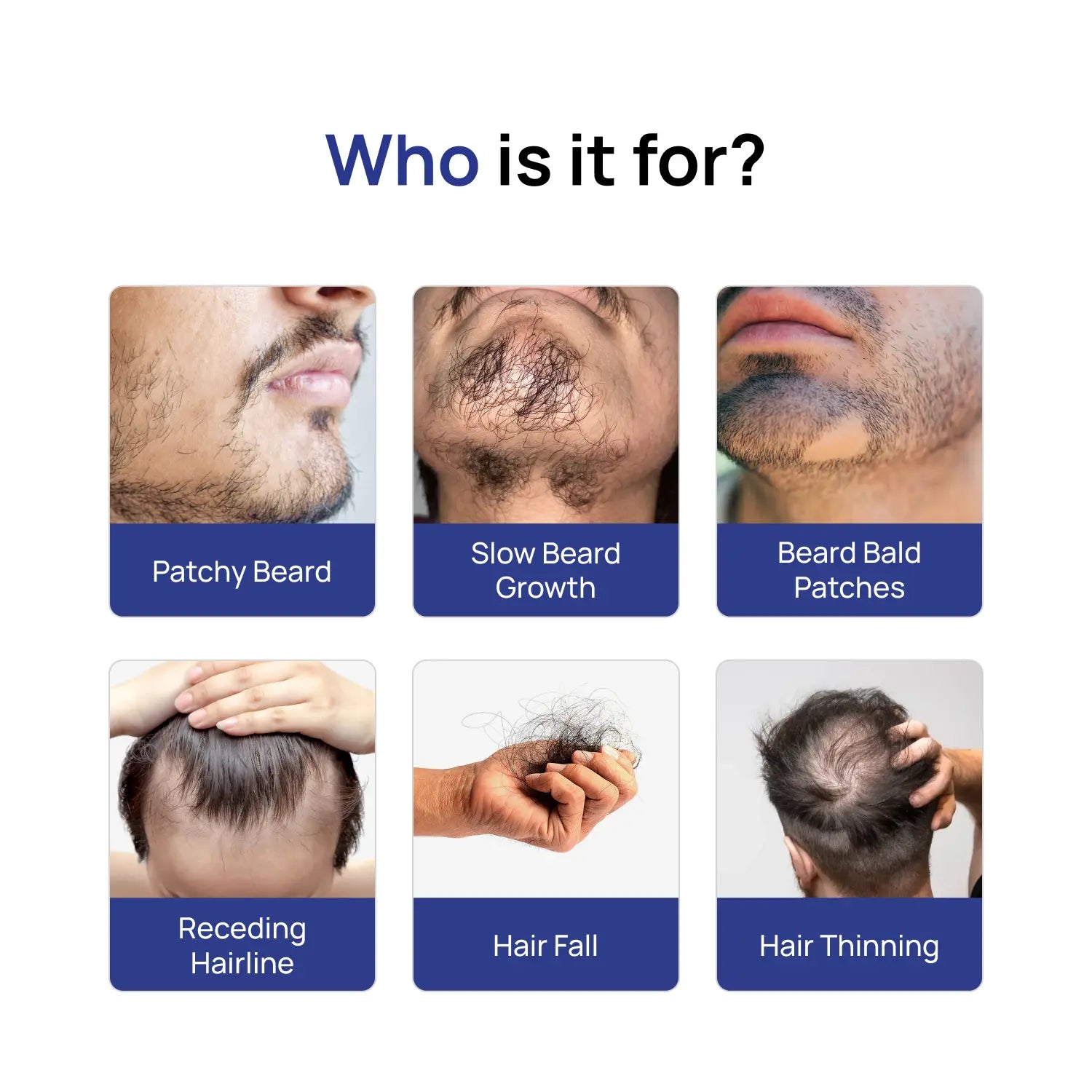 Beard Growth Super Kit <span>Minoxidil 5% + Derma Roller 0.5mm</span>