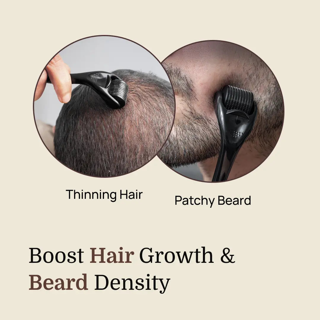 Derma Roller – 540 Titanium Microneedles for Hair & Beard Growth