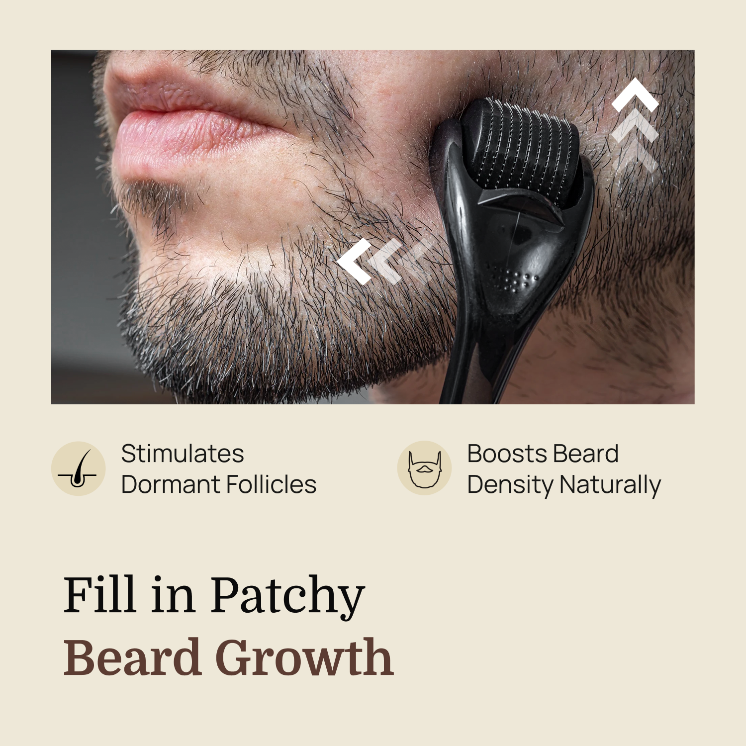 Derma Roller 1mm | 540 Titanium Microneedles