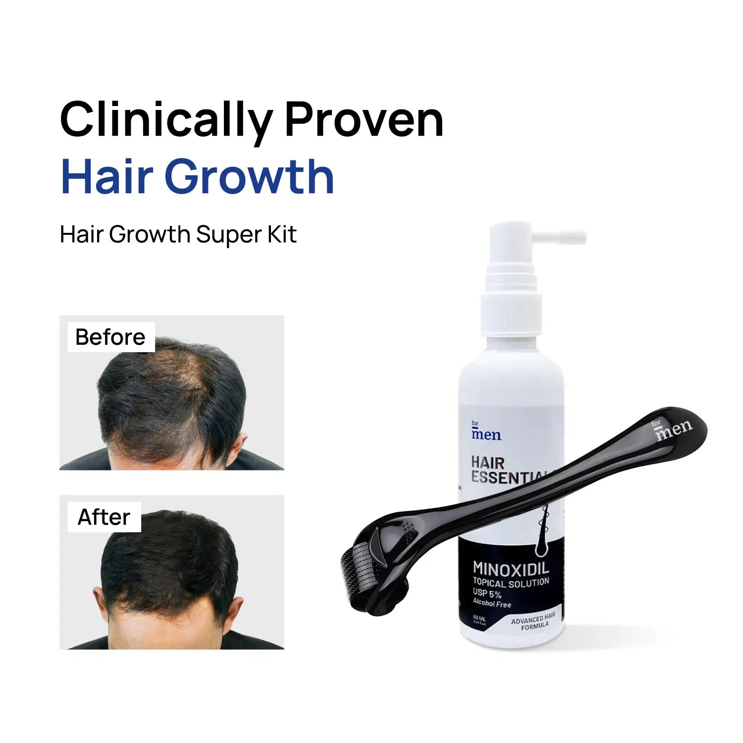 Hair Growth Super Kit <span>Minoxidil 5% + Derma Roller 1mm</span>