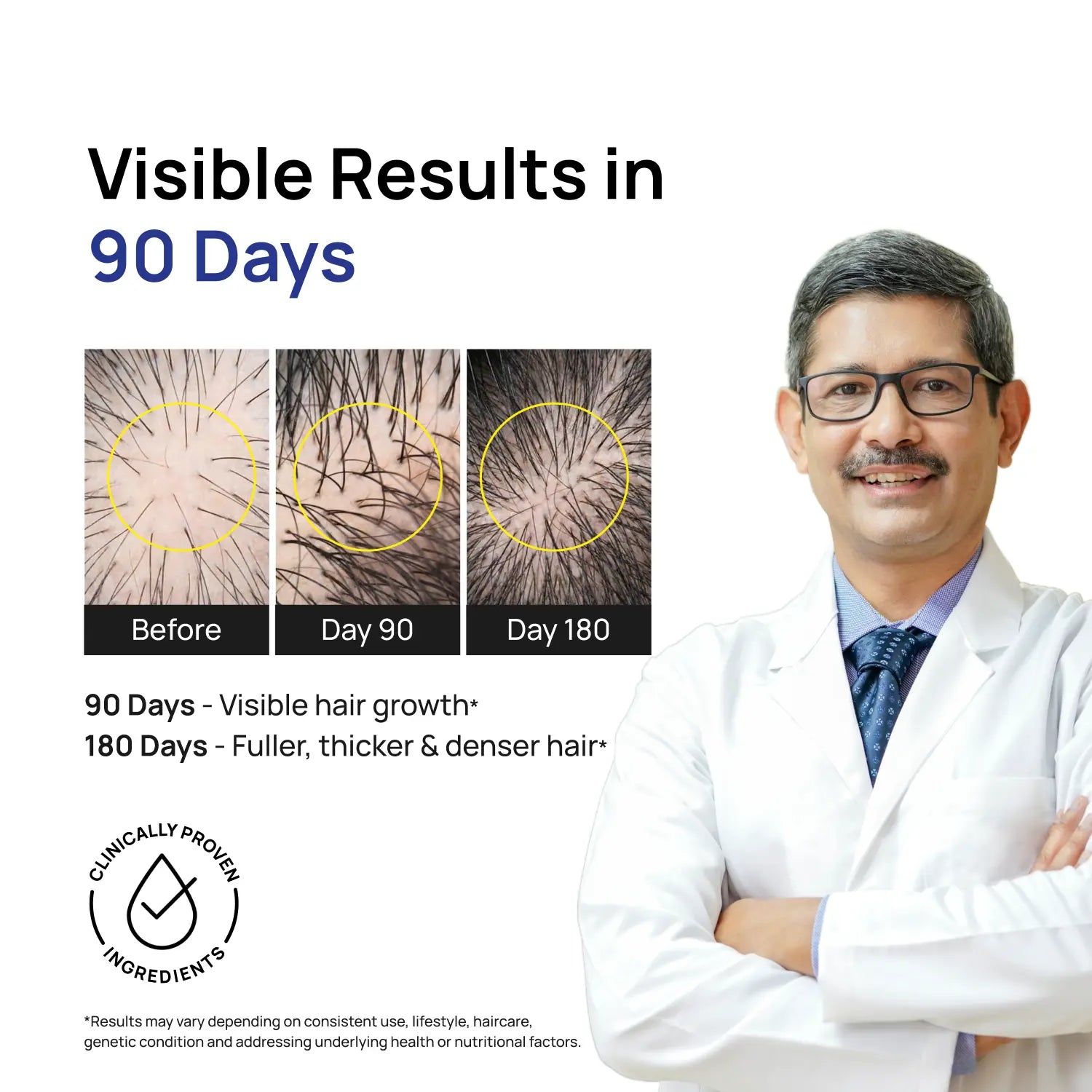 Hair Growth Super Kit <span>Minoxidil 5% + Derma Roller 1mm</span>