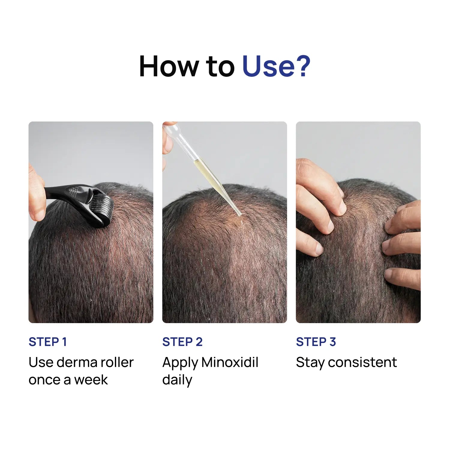 Hair Growth Super Kit <span>Minoxidil 5% + Derma Roller 1mm</span>