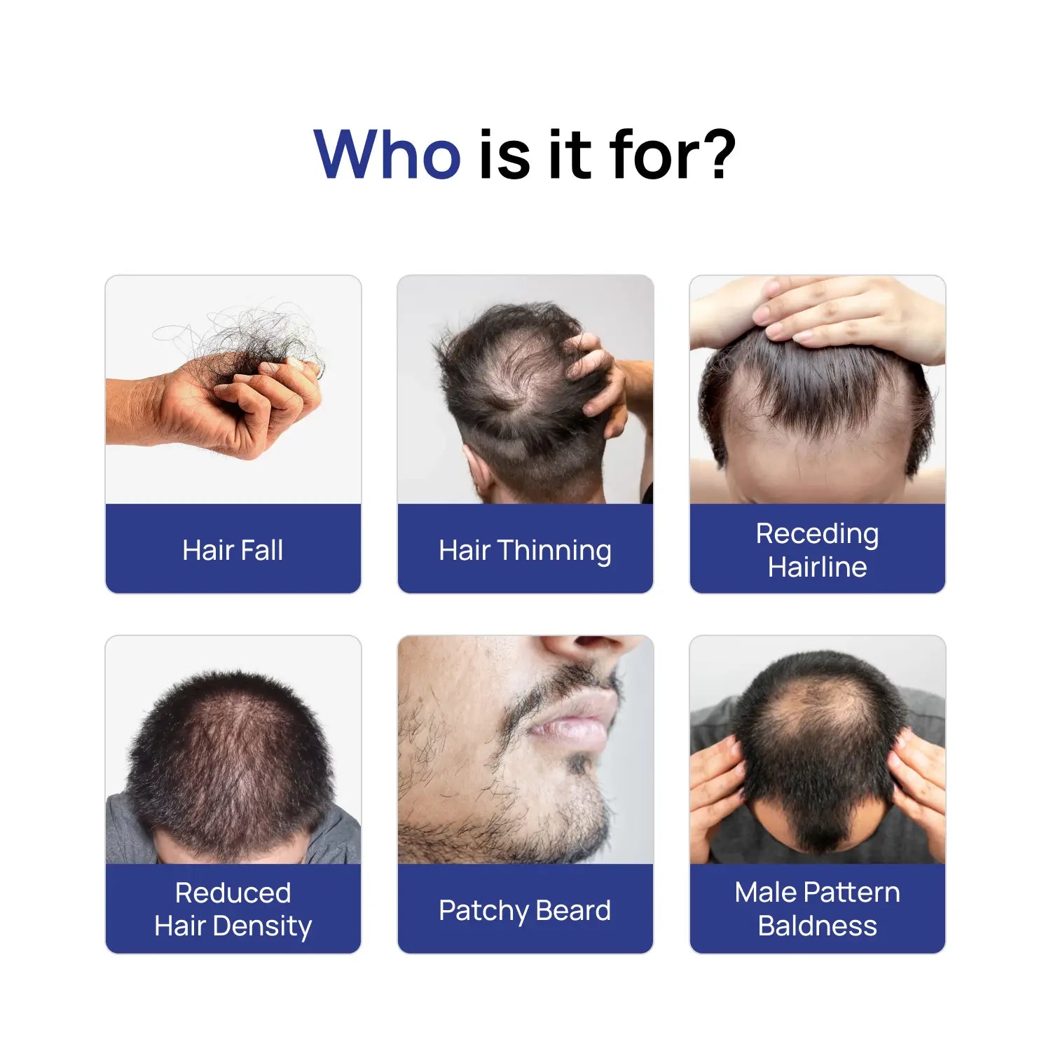 Minoxidil Topical Solution 5% – Clinically Proven Formula for Hair Regrowth (60ml)
